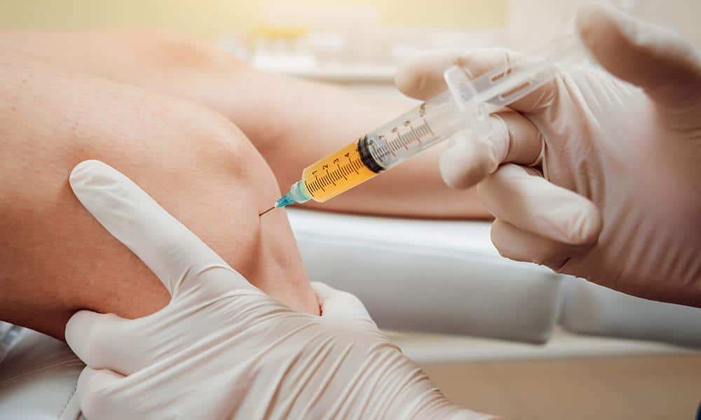 PRP Injections